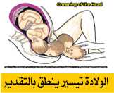 الولادة تيسير